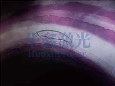 高主阀座修复前